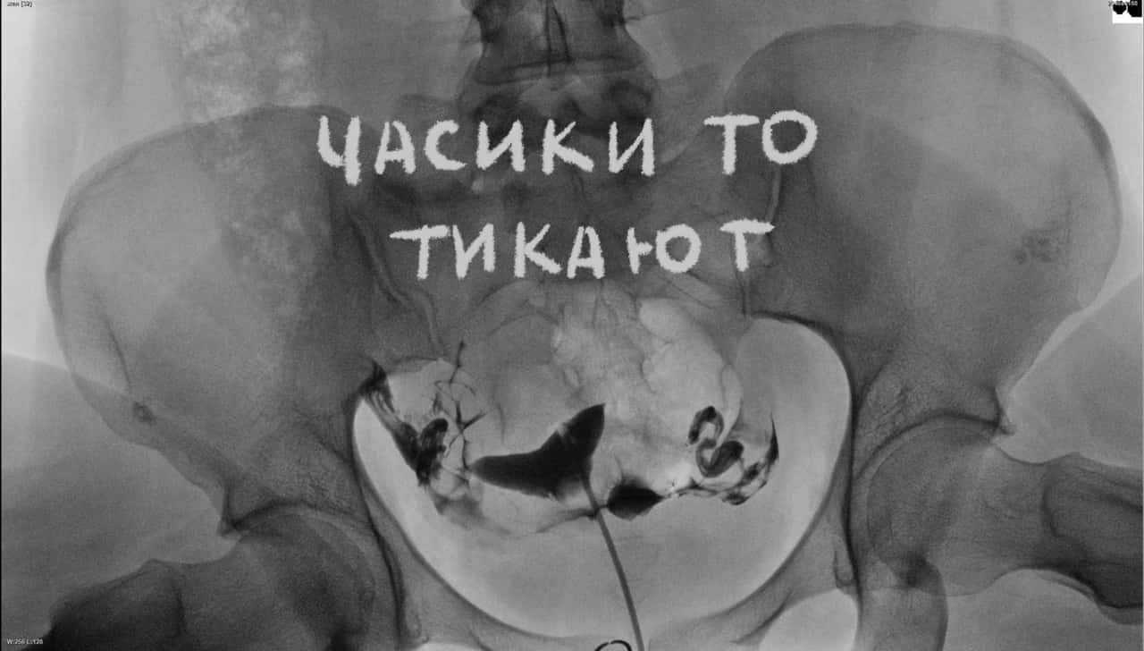 С 5 апреля в парк-отеле «Белые аллеи» выставка «Мам!» про совмещение ролей мать-художница