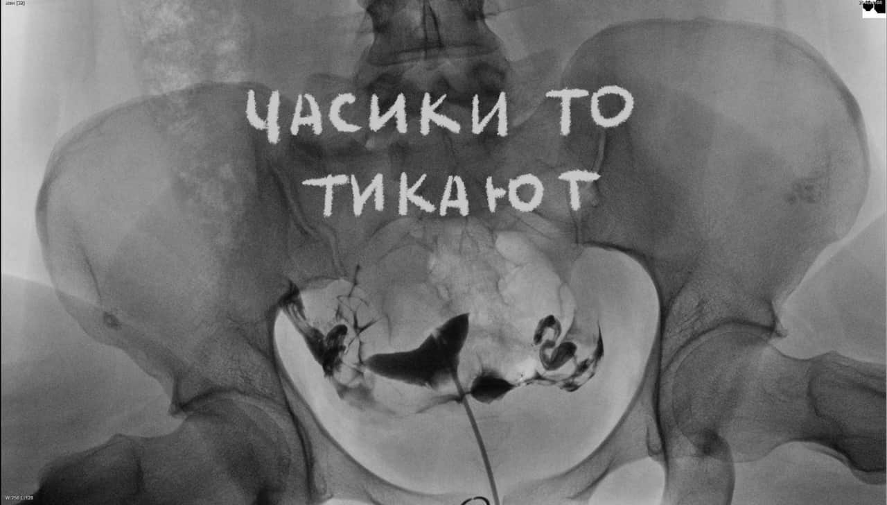 С 5 апреля в парк-отеле «Белые аллеи» выставка «Мам!» про совмещение ролей мать-художница